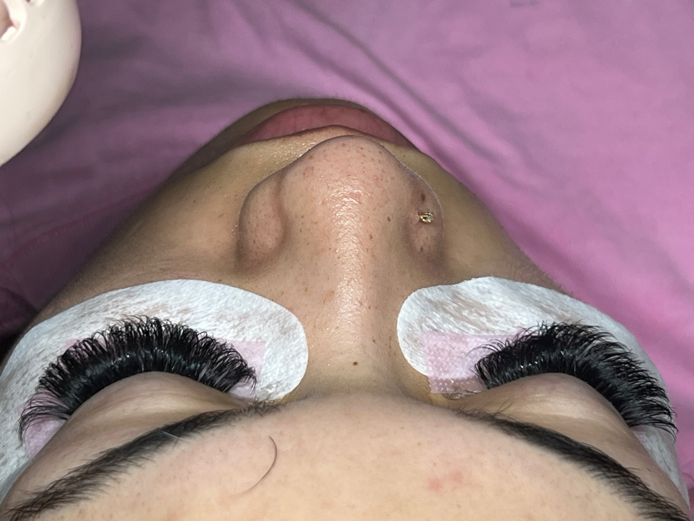 Volume Fill In (includes Hybrid)