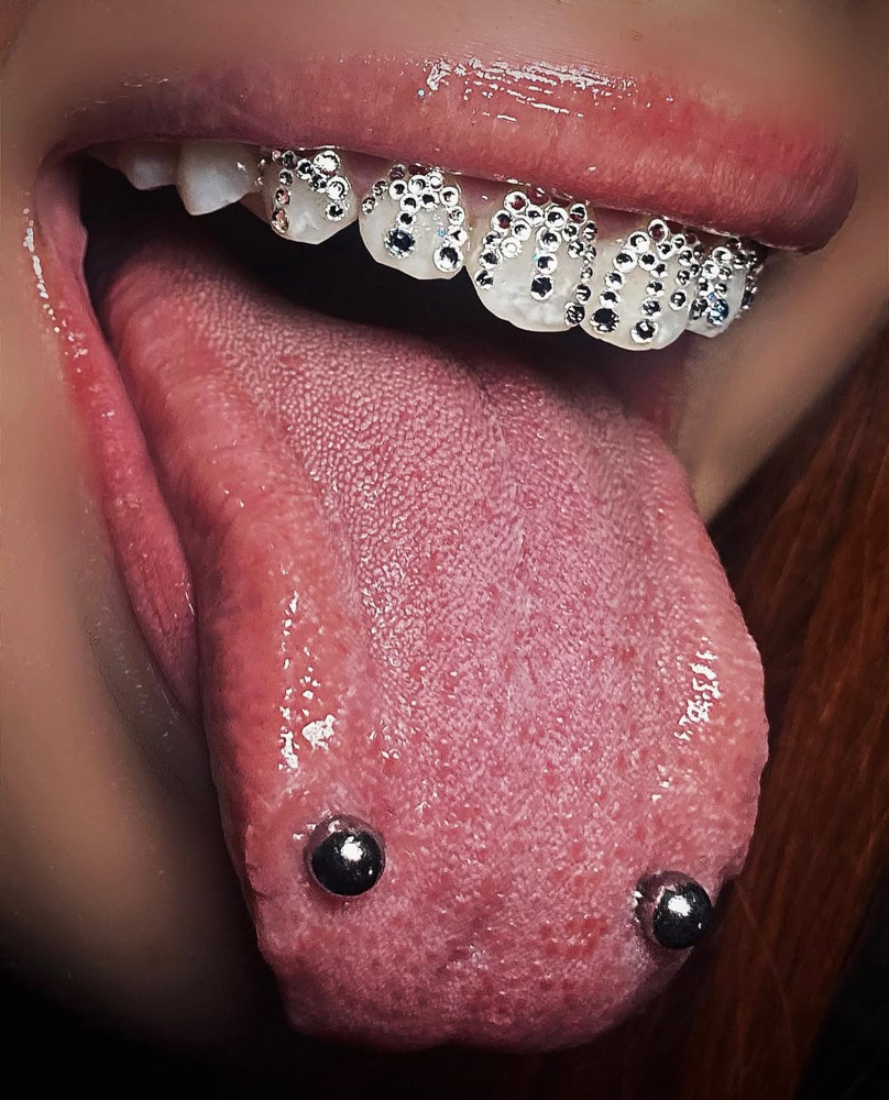 Tooth Jewelry