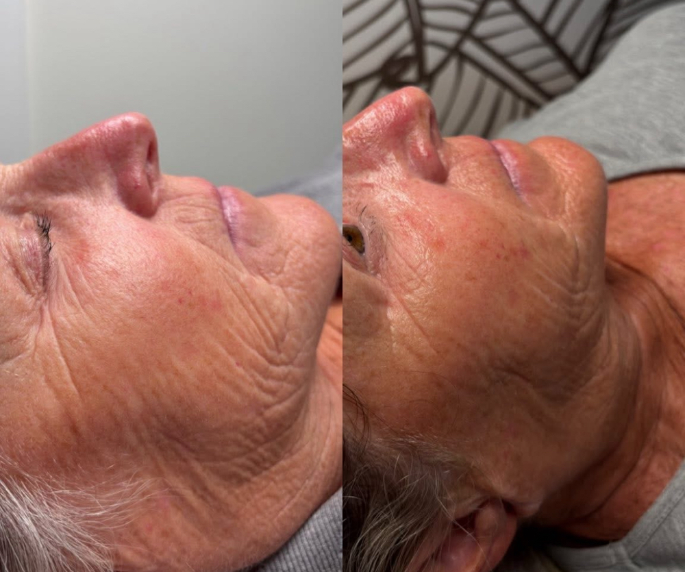 Deluxe Anti-Aging Facial