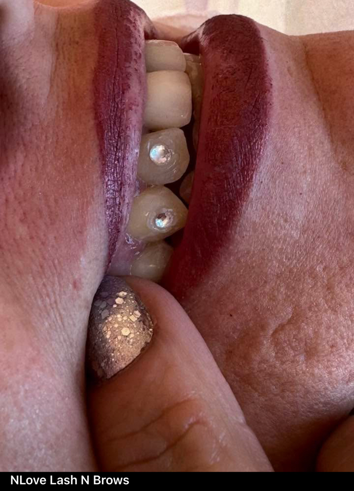 Tooth Gems