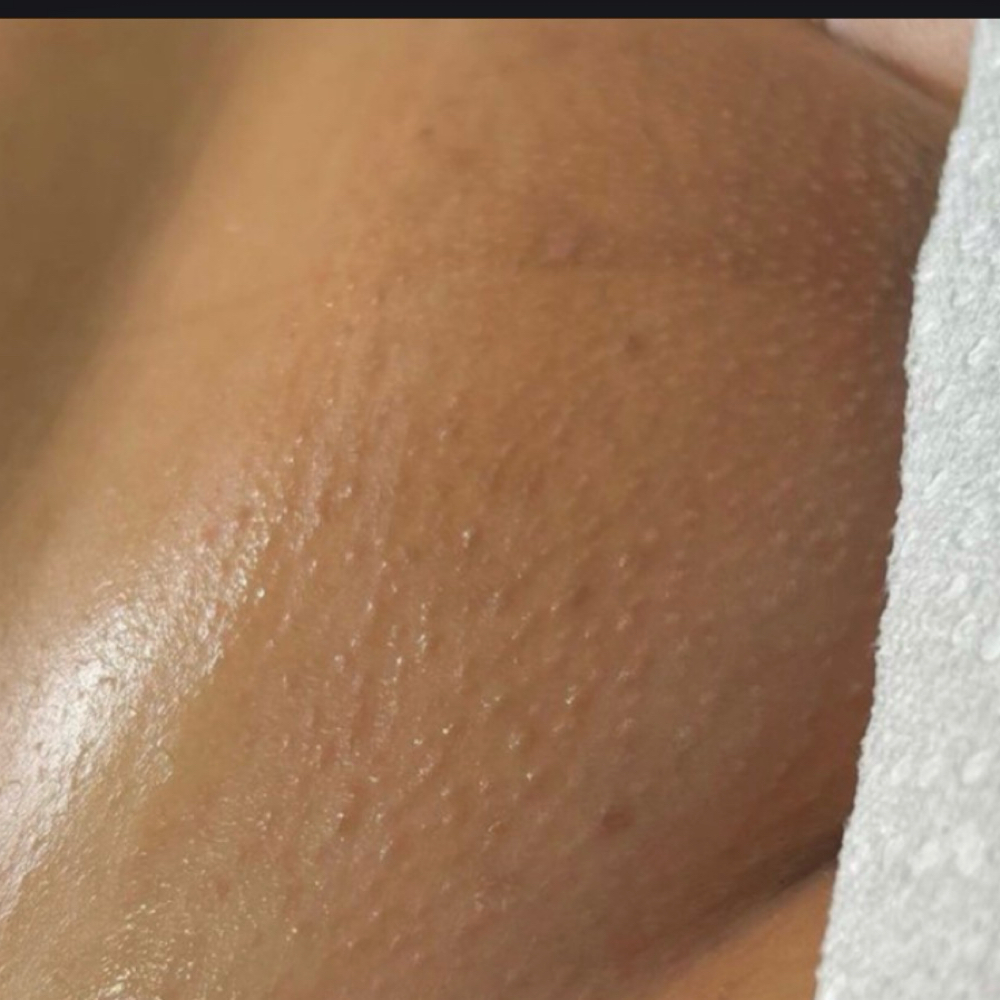 Brazilian Wax at Sweet Dreams Spa in Bronx, NY