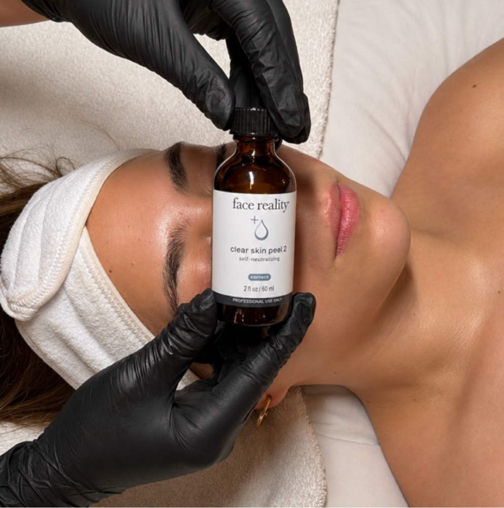 Acne Treatment at LeZen Esthetics in San Antonio, TX