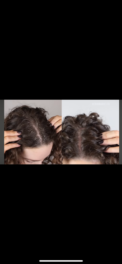 Scalp Detox Treatment