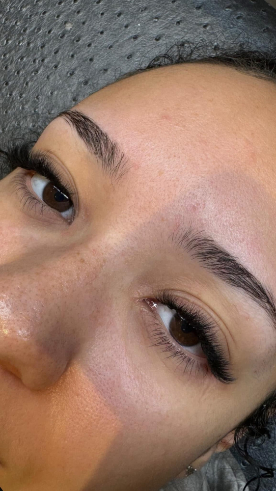 Volume Refill at Lucky Girl Aesthetics in Wichita, KS