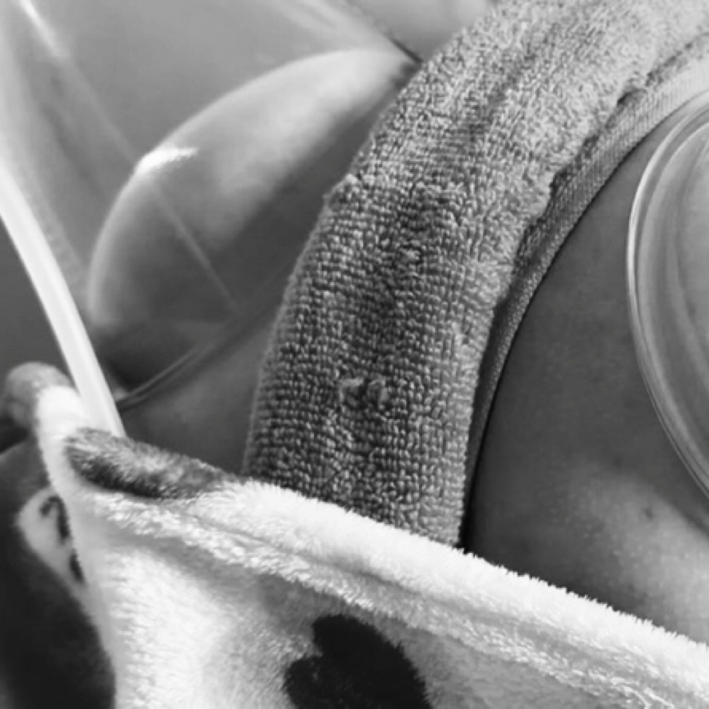 Buttocks Enhancement at RGV beauty studio in Edinburg, TX