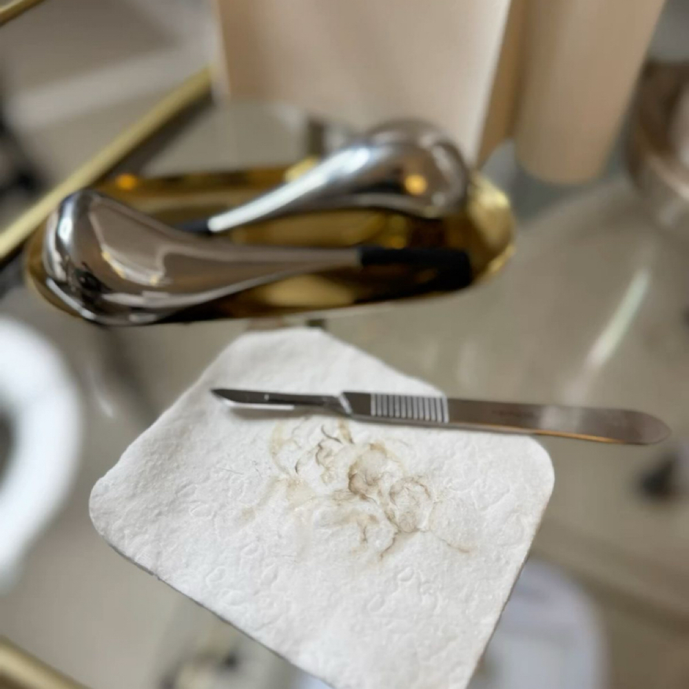 Dermaplane at Rein Aesthetics & Wellness in Alice, TX
