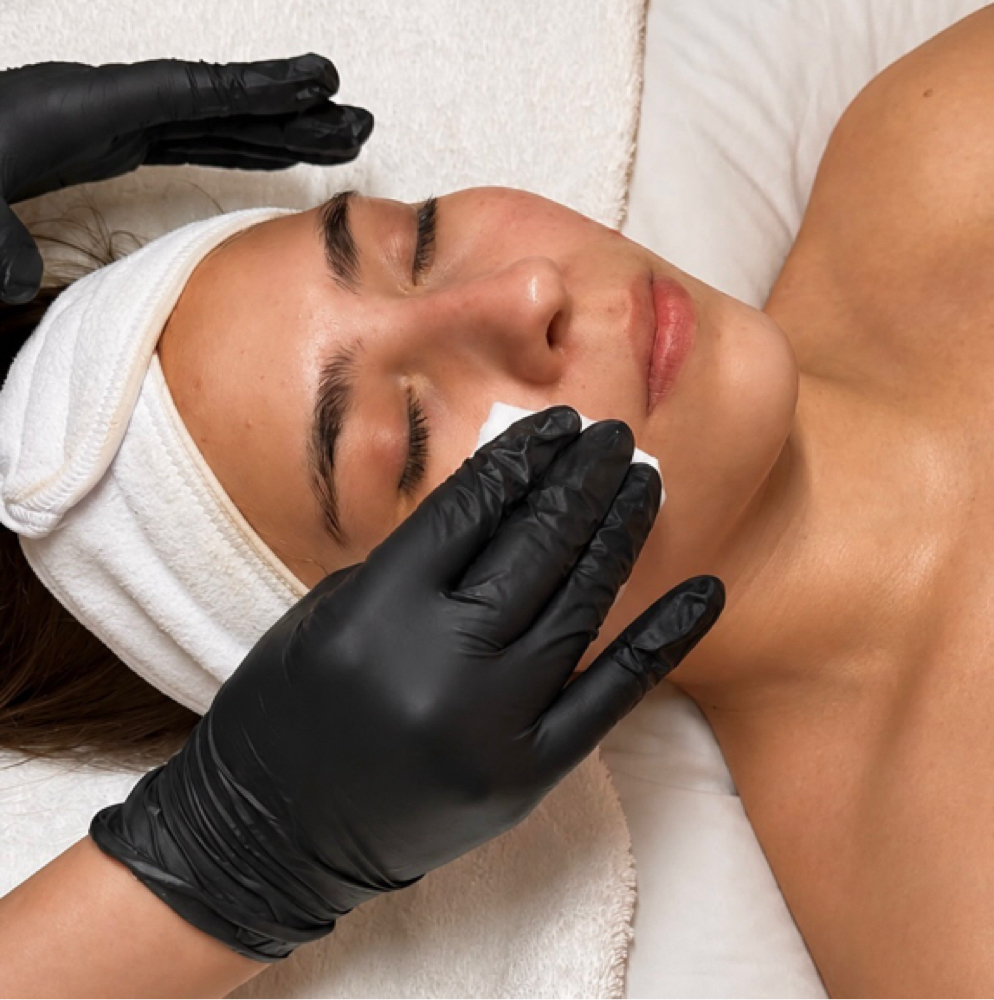 Chemical Peel at LeZen Esthetics in San Antonio, TX
