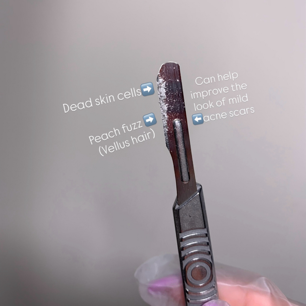 Bold Beauty Dermaplane Facial at B0ld Beauty by Tay Chanel in Lawrenceville, GA