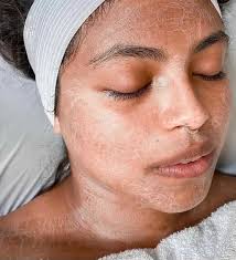 Protein Lift Oxygen Deluxe Facial