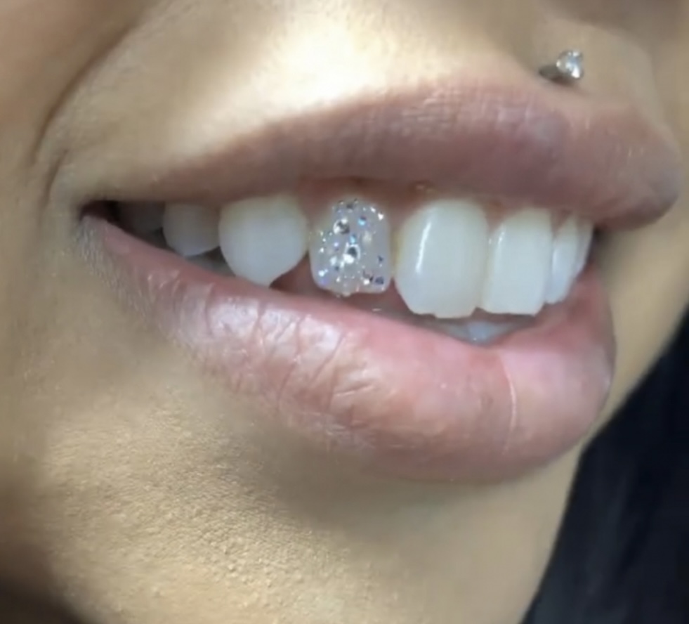Disco Ball Bling Tooth  💎