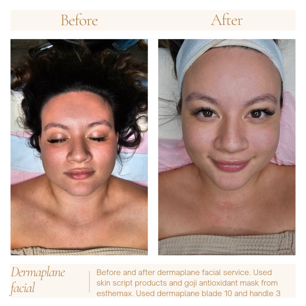 Majestic Dermaplaning Facial