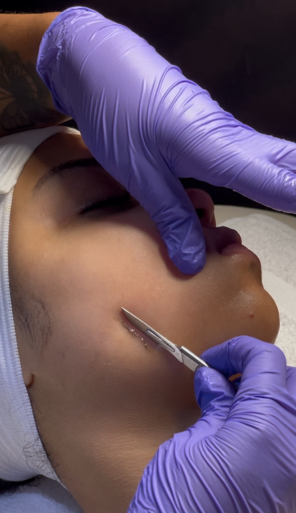 Dermaplaning Facial