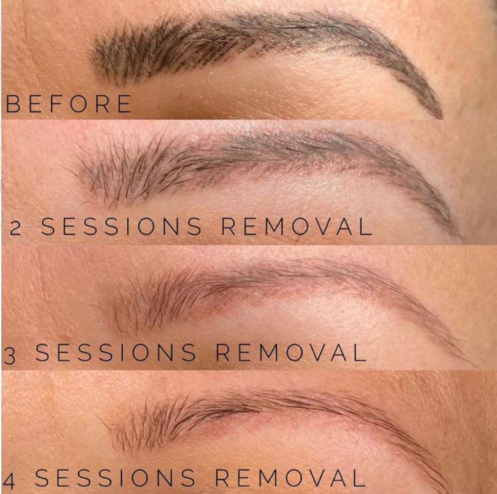 Brow Lightnening / Fading Treatment