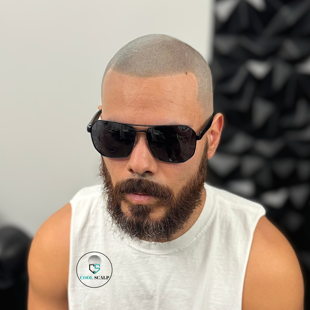 Scalp Micropigmentation Touch-Up Session