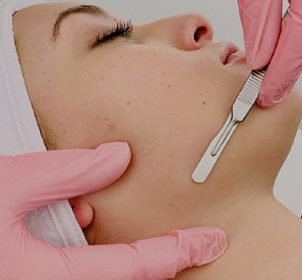 Dermaplaning