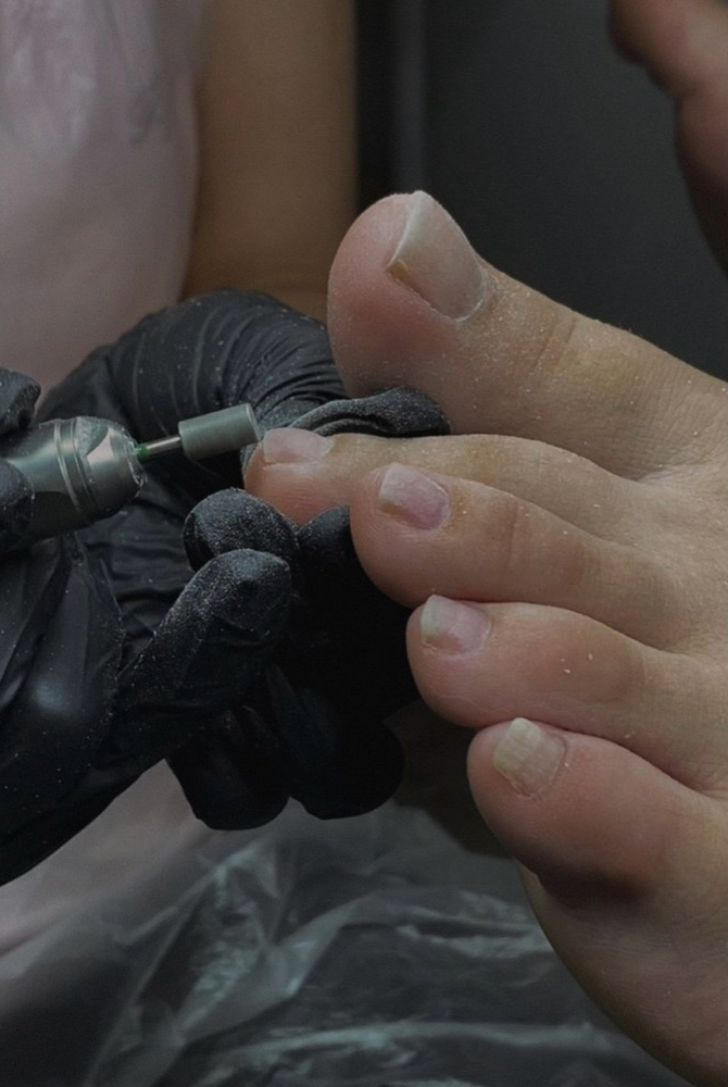 Pedicure