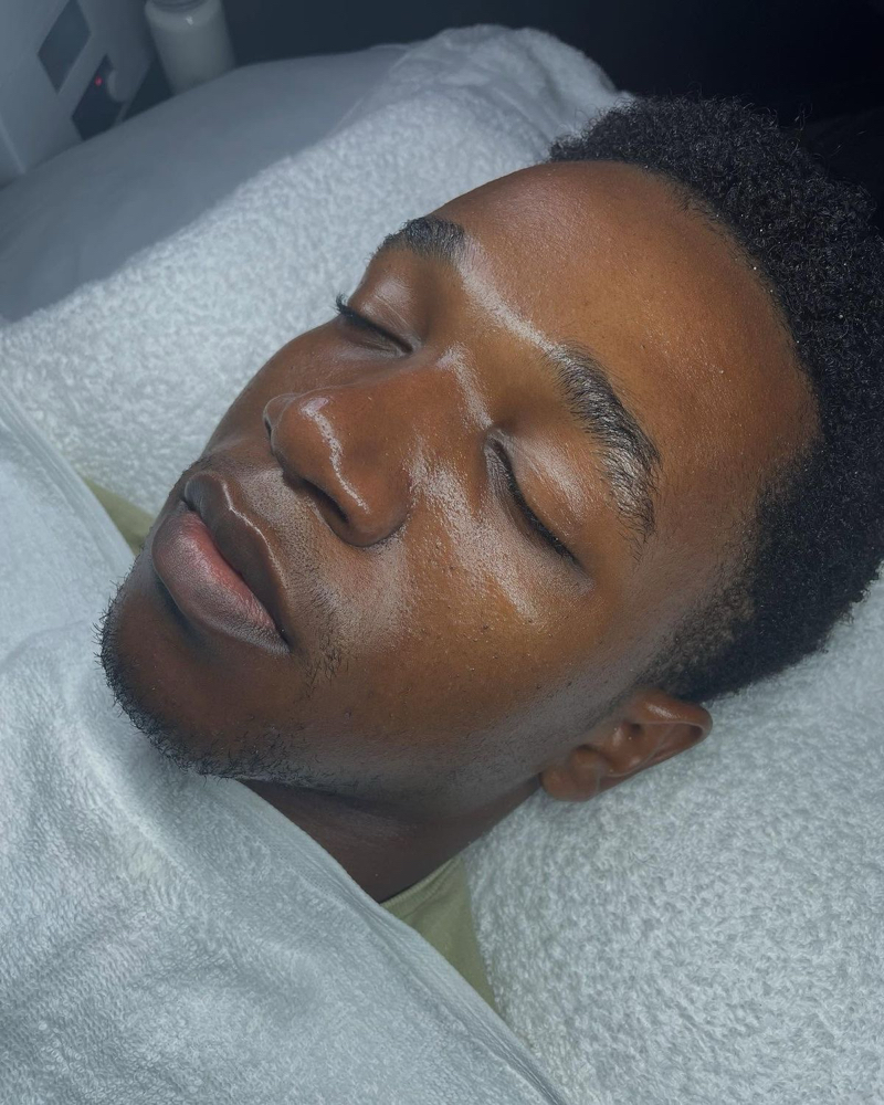 BROfaciaL