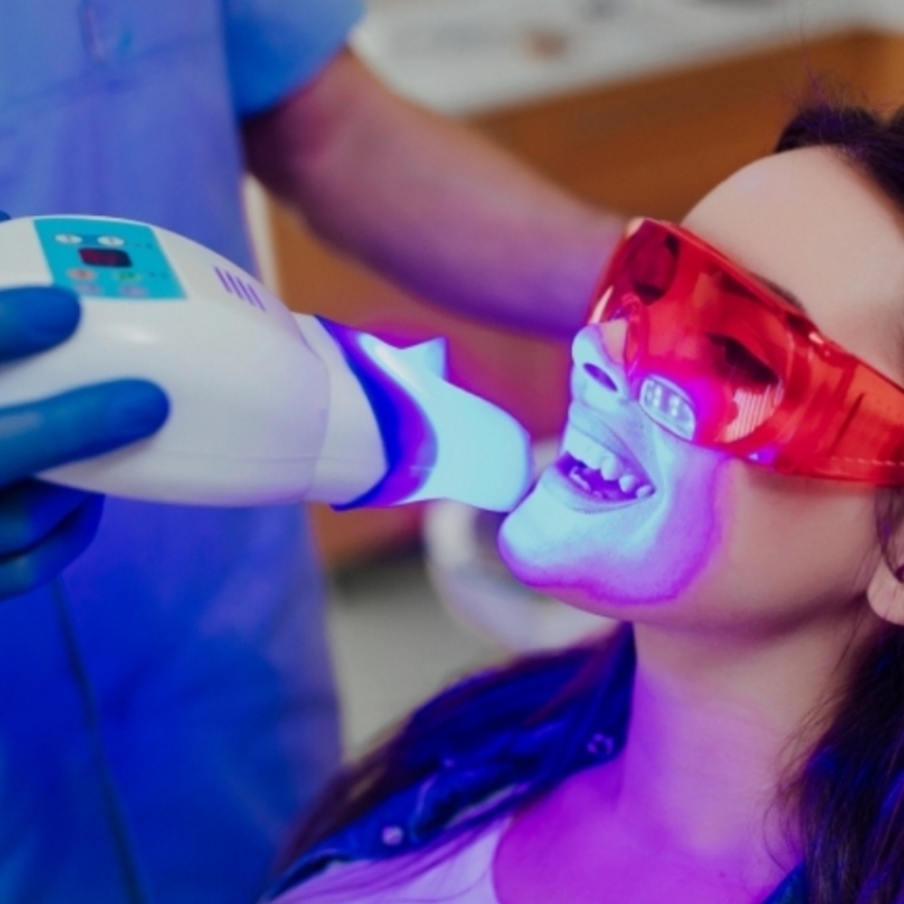 Teeth Whitening Session (30 Min) at Le Bar Beaute in Indian Trail, NC