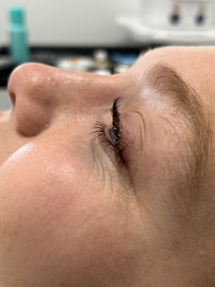 Lash Lift
