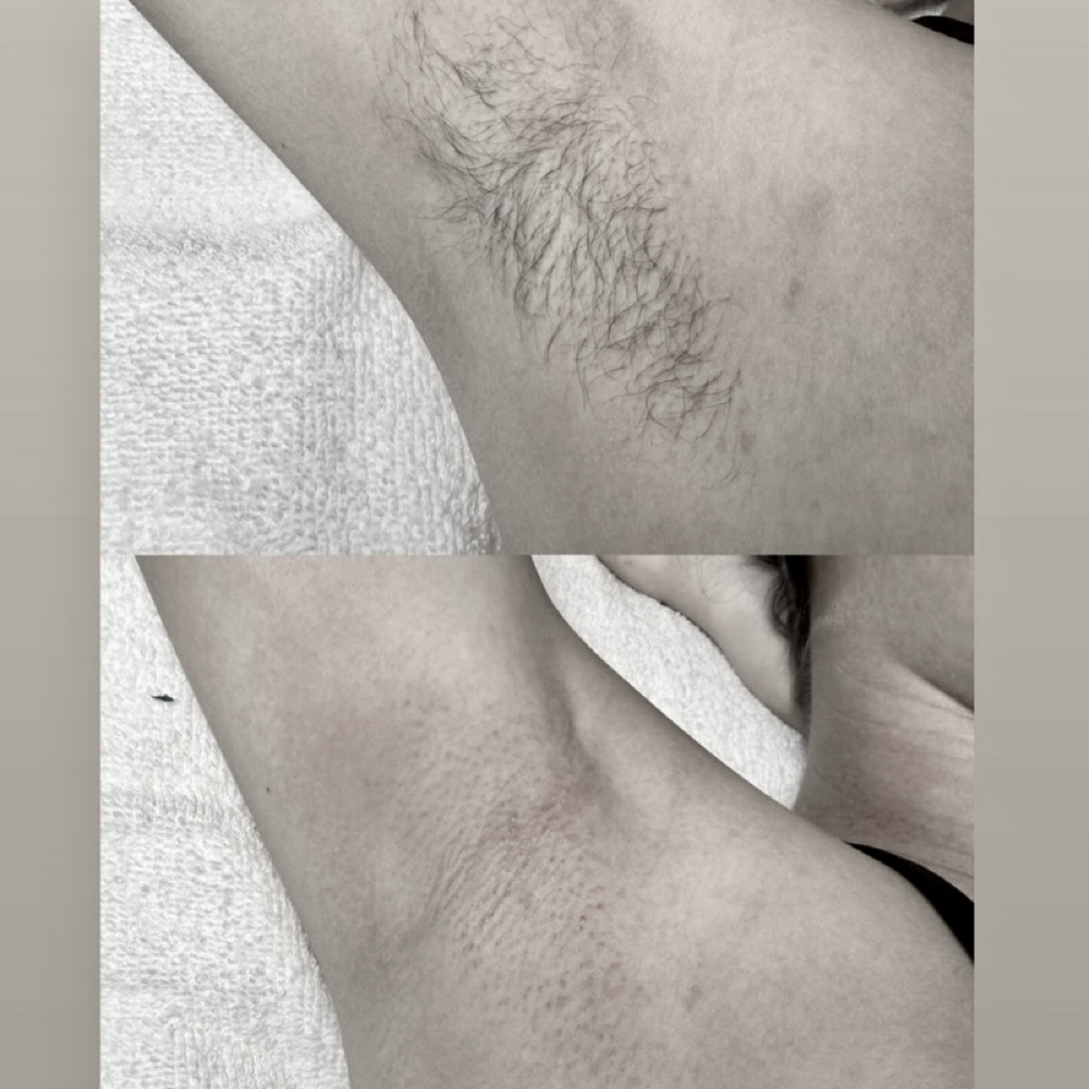 UnderArm Wax at The Shop in Stigler, OK