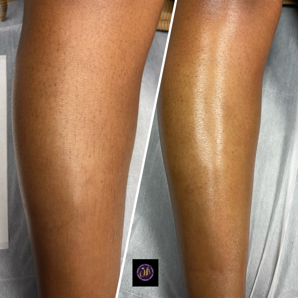 Lower Leg Wax