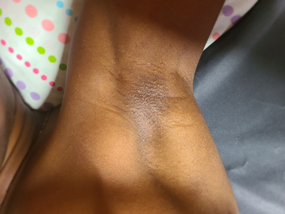 Underarm Wax