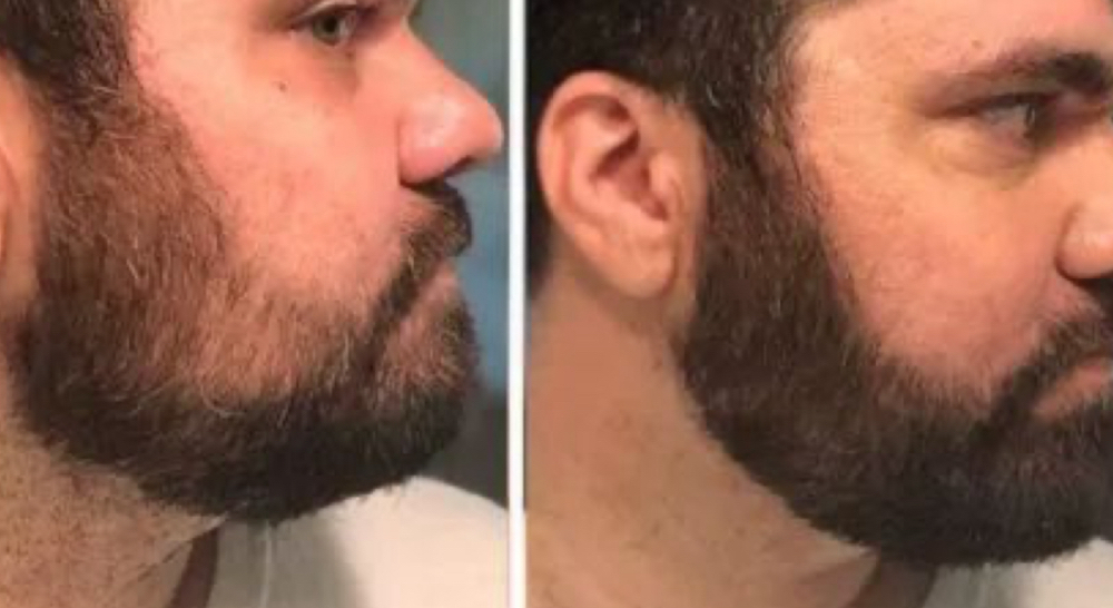 Beard Tint/color