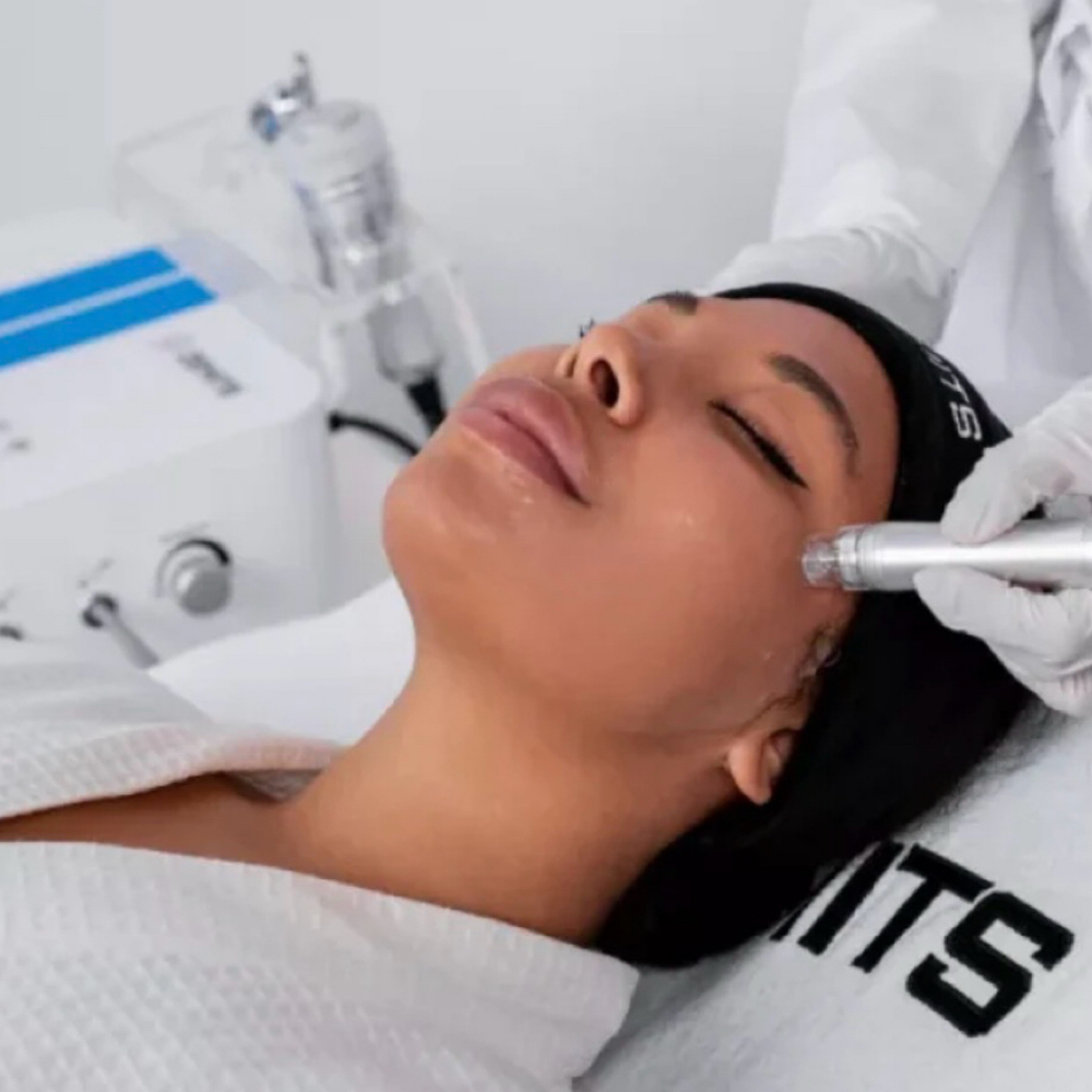 Hydrodiamond Golden Facial at Golden Cloud Esthetics in Whittier, CA