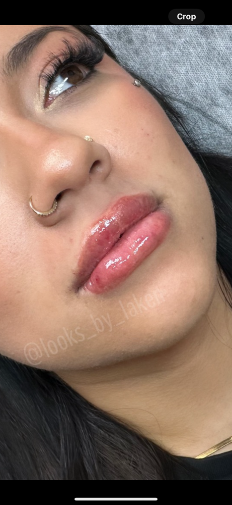 Hyaluron Pen Lip Filler (1 ML)