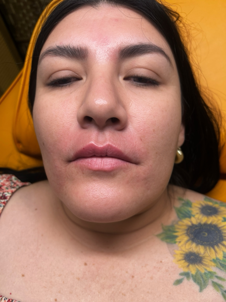 Bio-Gel
