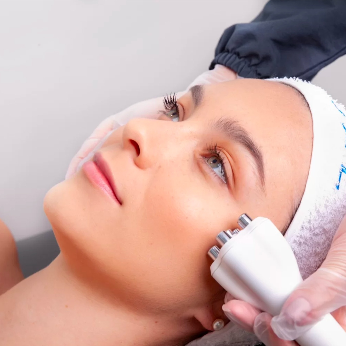 Venus Legacy + Ice Facial at The Body Club in Englewood, NJ