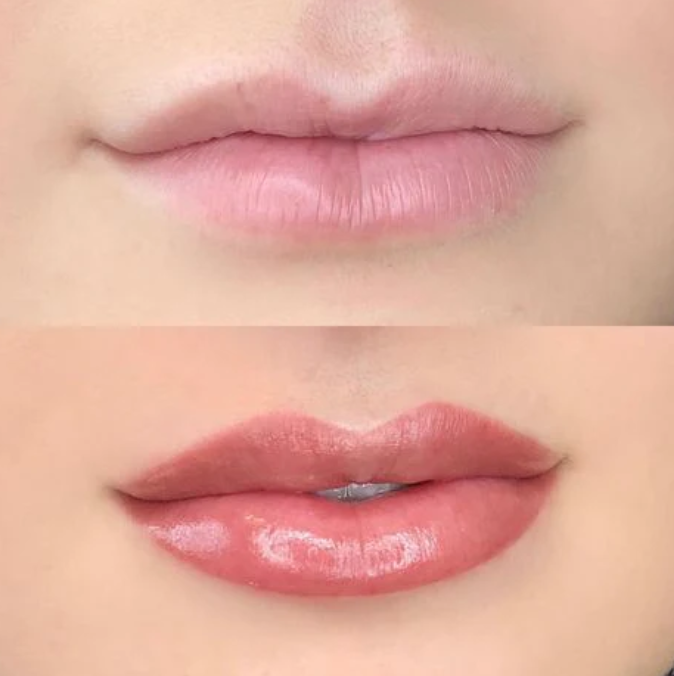 Sculpted Lips (Without Touchup)$400