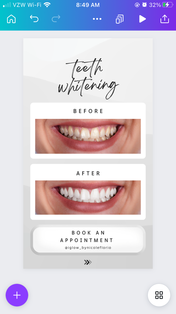 Teeth Whitening 3 Sessions ($299)