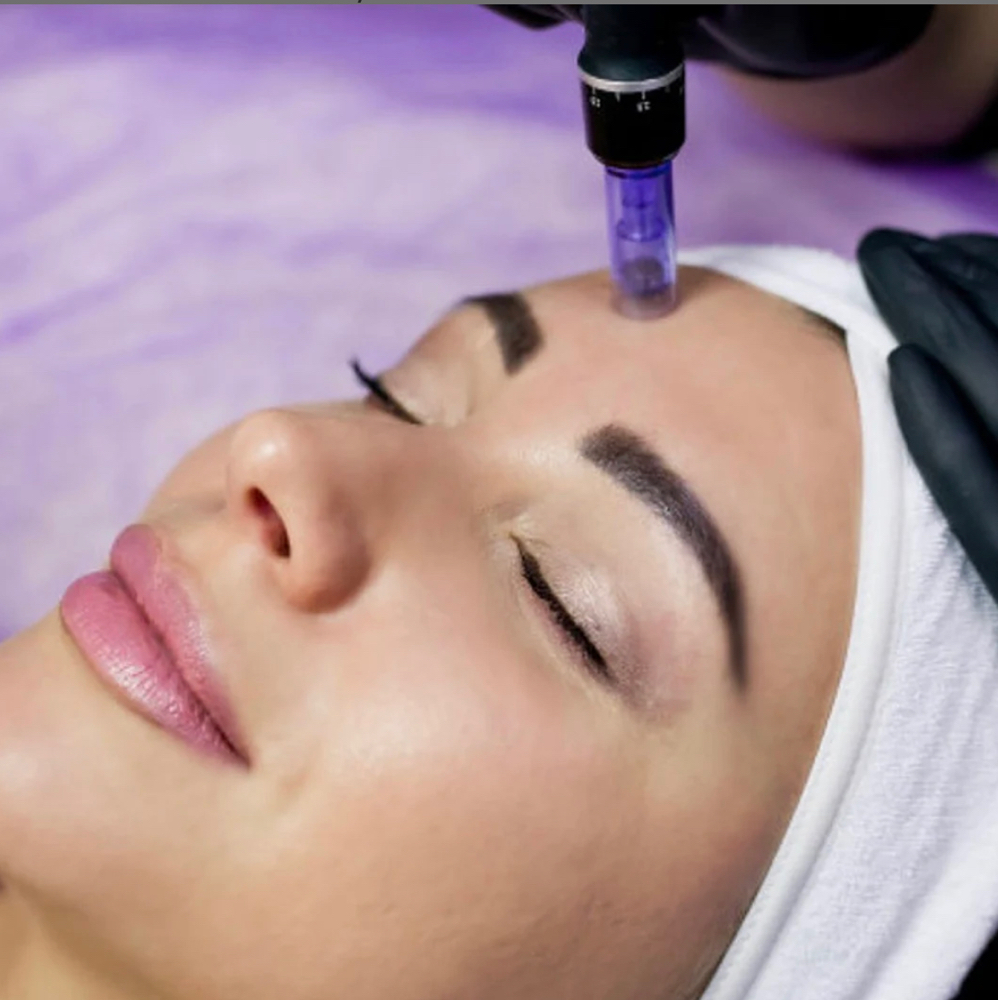 Microneedle