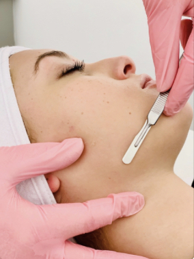 Dermaplaning