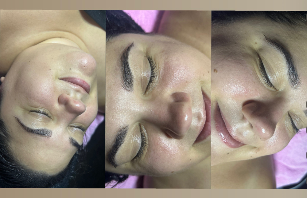 The Luminfusion Facial