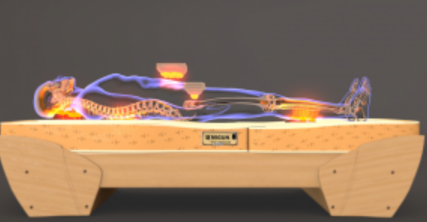 Migun 4 Pack 25-30 Min