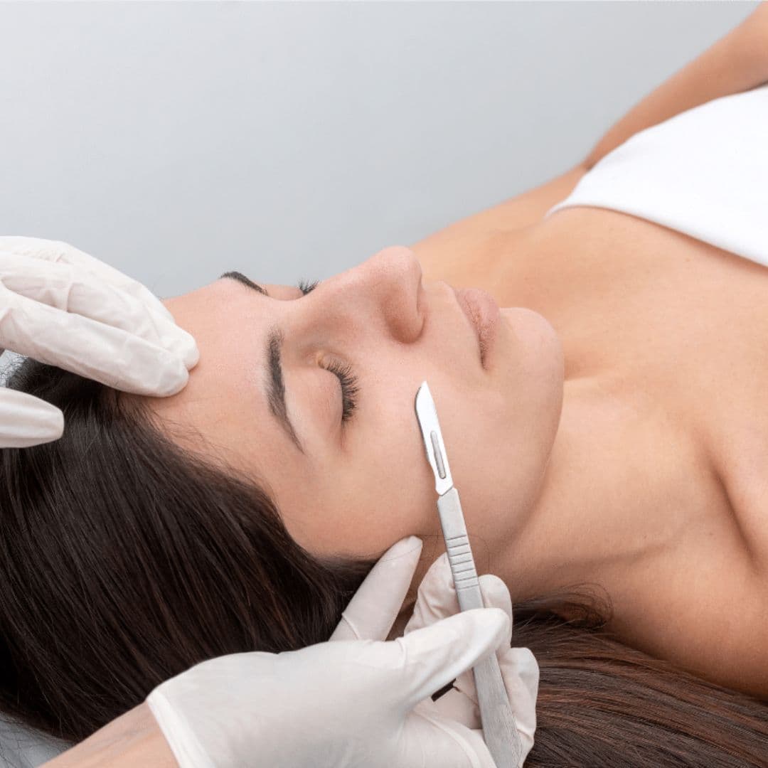 Dermaplaning