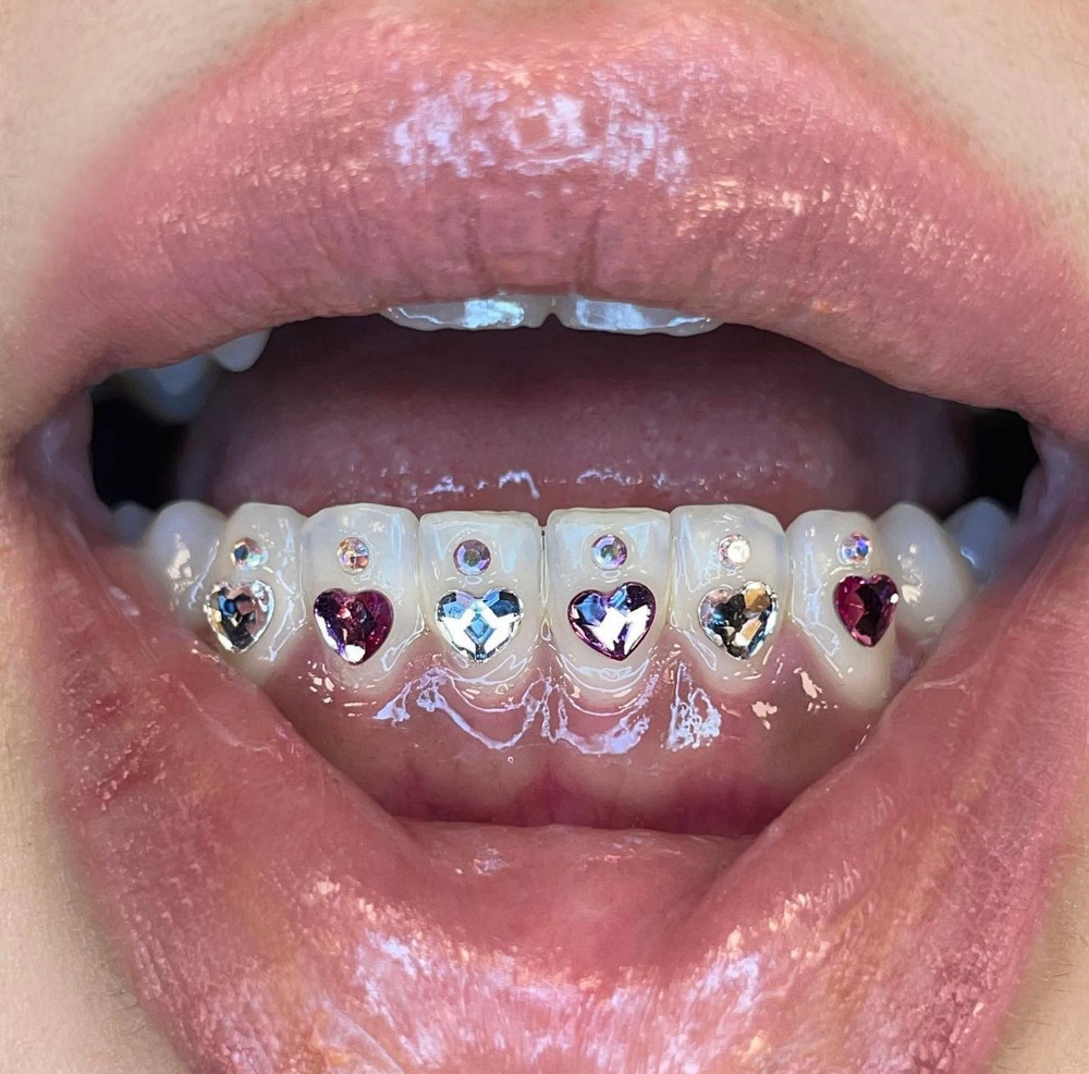 Tooth Gem Design (3-4 gems)