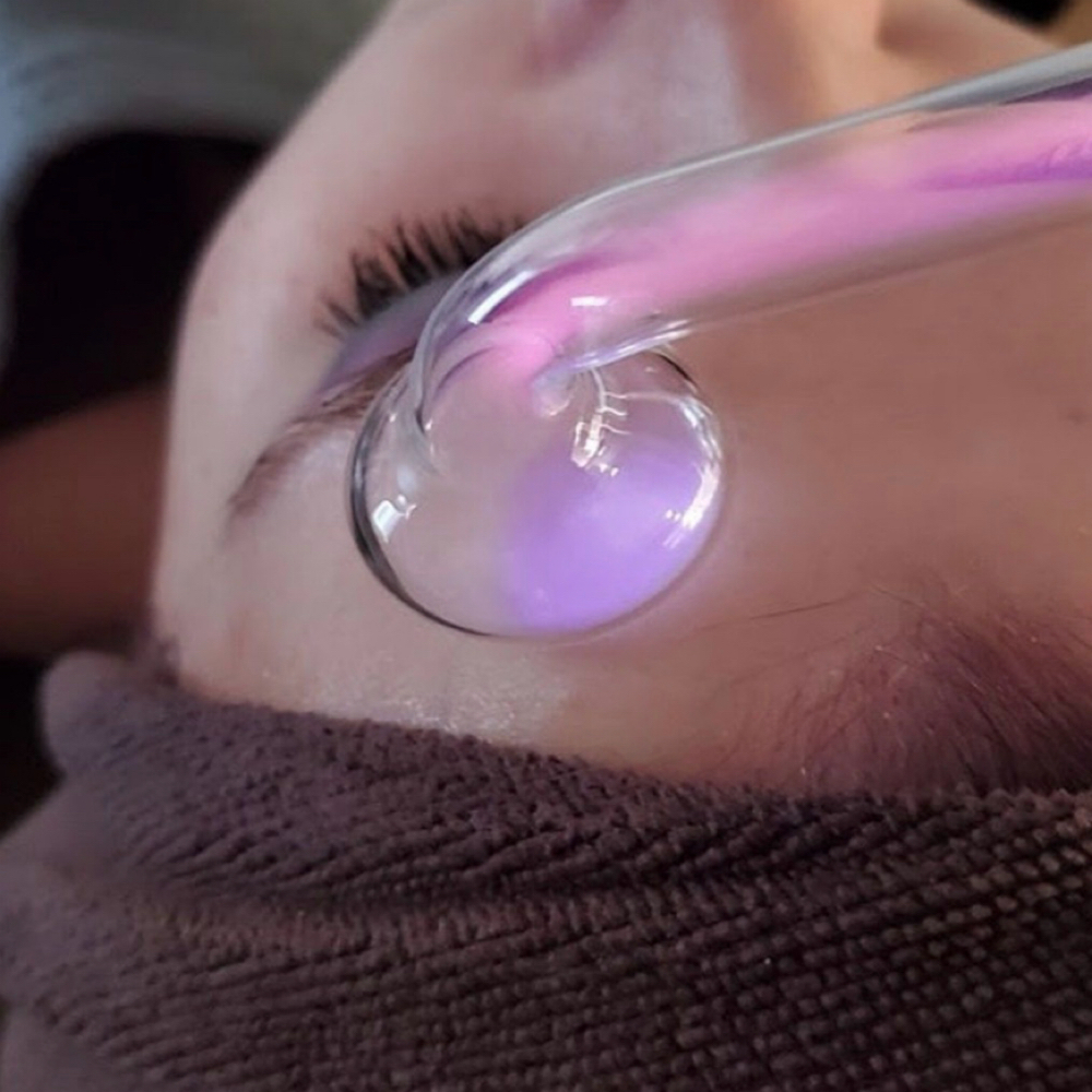 Acne Clarifying Facial at Retro Esthetics in San Clemente, CA