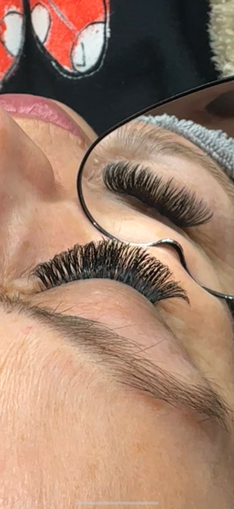 Mega Volume Fill