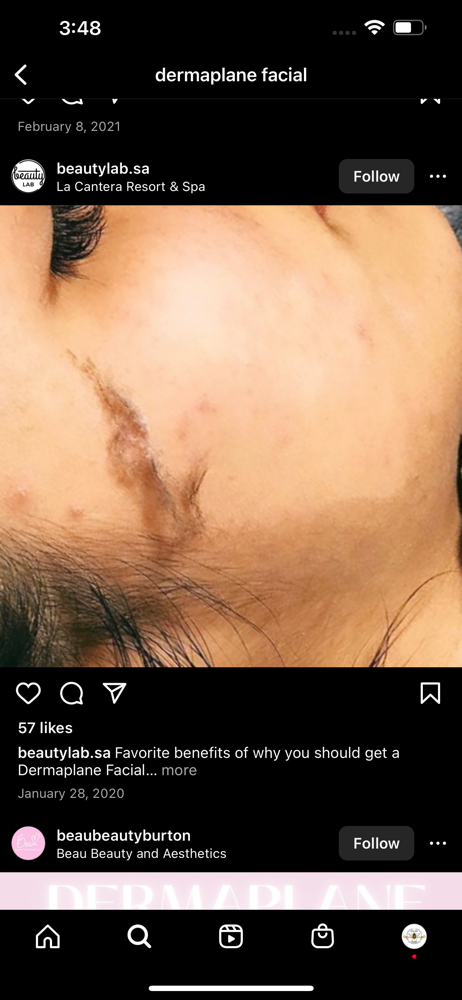 Dermaplaning Add On Or By Itself