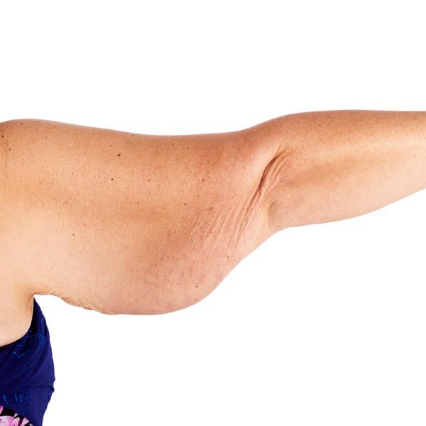 Arms N Shoulder Definition Package