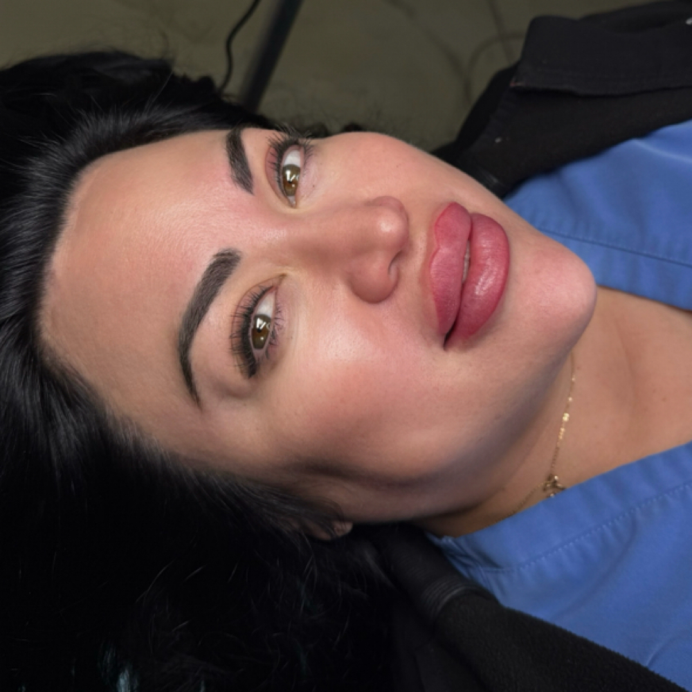 Non Surgical Full Facial balancing at Cosmetic Artistry in Lancaster, CA