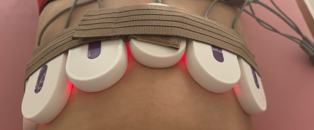 Belly Burn Fats Laser Treatment