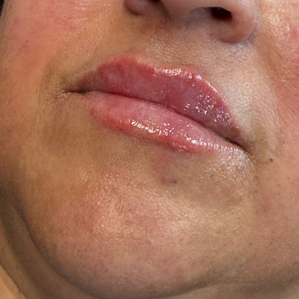 Mini Pout Filler at Lc Beauty Vault in Sinton, TX