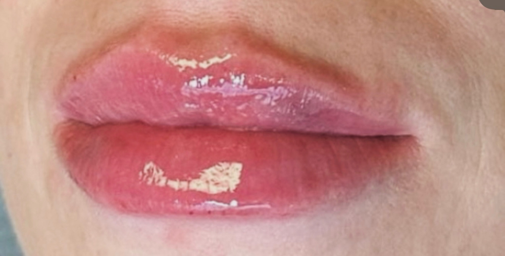 Filler dissolve at Bliss by criss llc in Buda, TX