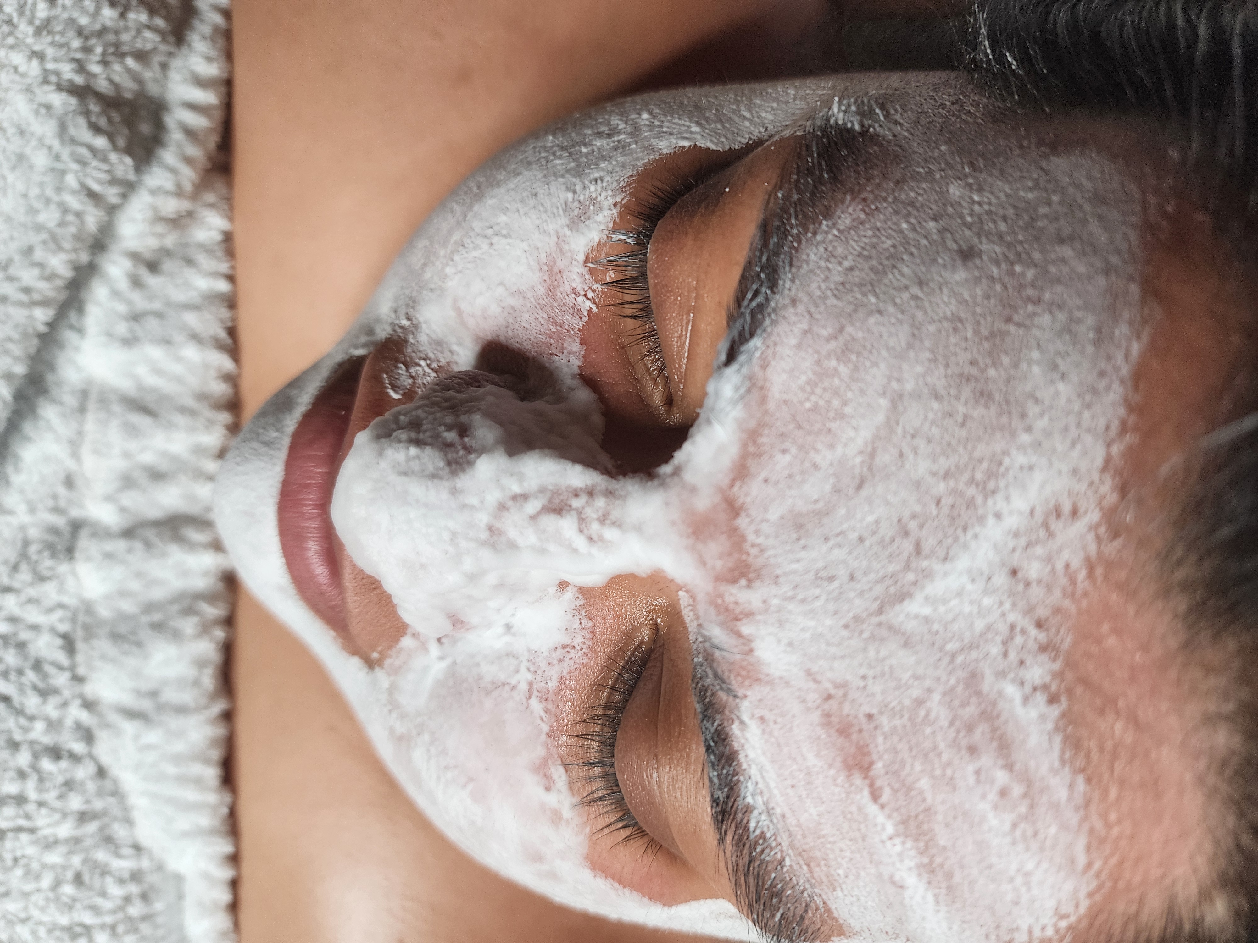 Radiant Acne Facial