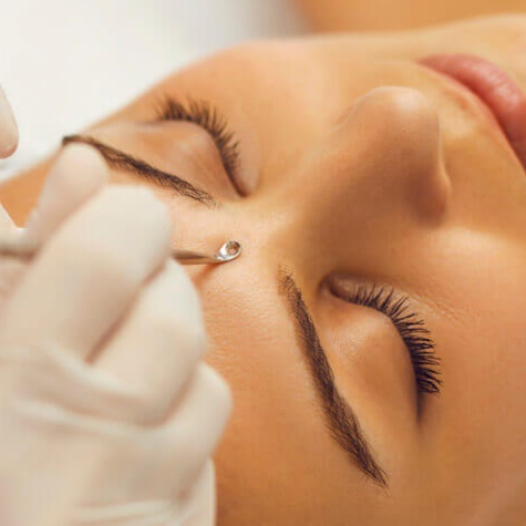 ADD-ON: Extractions at Skin Theory Studio in Jeffersonville, IN