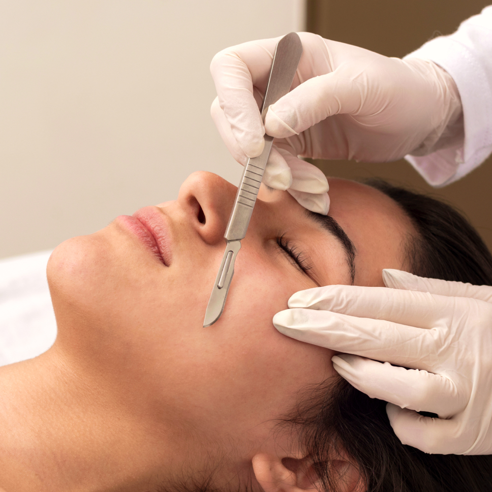 Happy Peel With Dermaplaning